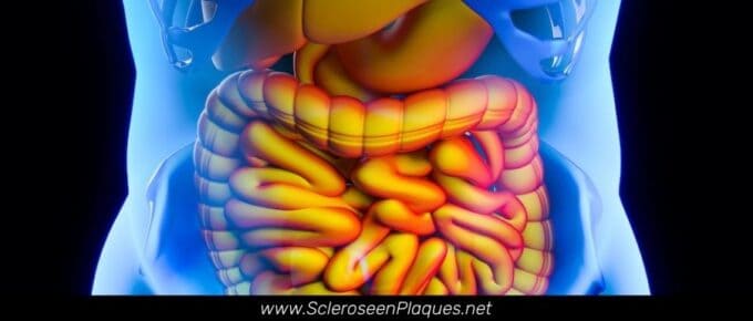 Syndrome de l'intestin perméable