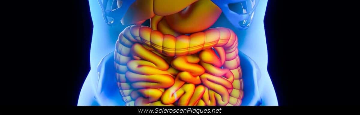 Syndrome de l'intestin perméable