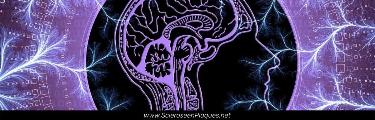 Examen neurologique pour la Sclérose en Plaques